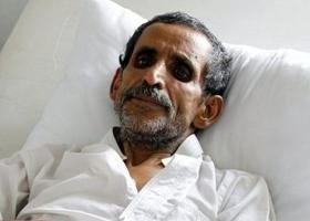 იემენში ქოლერით დაავადებულთა რიცხვმა 200.000-ს გადააჭარბა