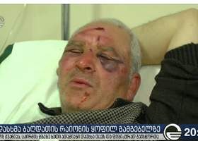 ბაღდათის ყოფილი გამგებელი ნიკოლოზ ჟვანია საირმის გზაზე 5-მა ადამიანმა ცემა - ჟვანია ამას თემურ კოხოძეს აბრალებს