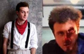 ექიმებმა მსახიობ დემეტრე ნაყოფიას თვალი შეუნარჩუნეს ექიმებმა მსახიობ დემეტრე ნაყოფიას თვალი შეუნარჩუნეს