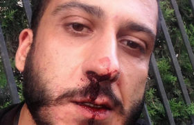 პირველი არხის ჟურნალისტს სამართალდამცველებმა სცემეს და დააკავეს პირველი არხის ჟურნალისტს სამართალდამცველებმა სცემეს და დააკავეს