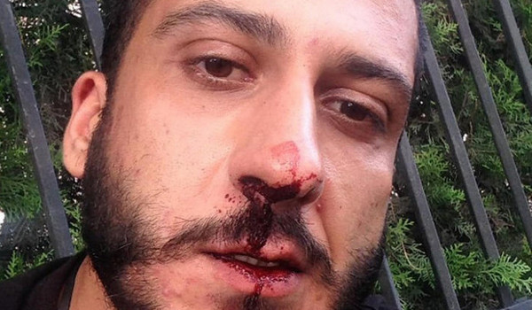 პირველი არხის ჟურნალისტს სამართალდამცველებმა სცემეს და დააკავეს