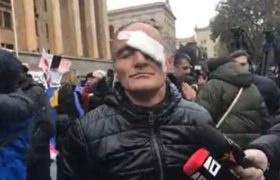 ზაზა ლიპარტია, რომელსაც დარბევისას თვალი დაუზიანდა, კვლავ აქციაზე მივიდა