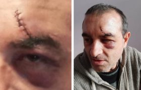 თენგო ქუთელია - „სპეცრაზმელებმა ვერცხლისფერი კასტეტი დამარტყეს და შუბლი გამიტეხეს, 8 ნაკერი მადევს“