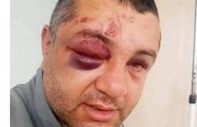 გუდაურში მკვლელობისთვის დაკავებული მერაბ კობიაშვილი სასტიკადაა ნაცემი - ახალი დეტალები