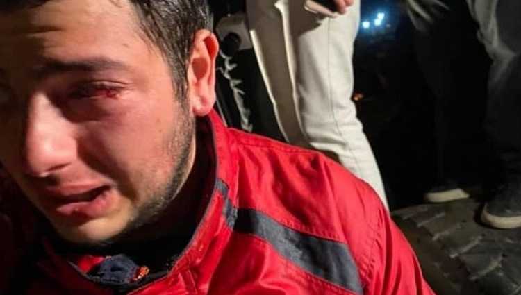 ცესკოსთან დარბევისას ტვ პირველის ოპერატორმა თვალის ტრავმა მიიღო