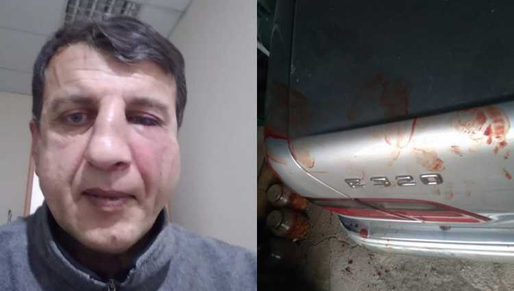 „გირჩი - მეტი თავისუფლების“ წევრს, გოგიტა რობიტაშვილს, თავს დაესხნენ