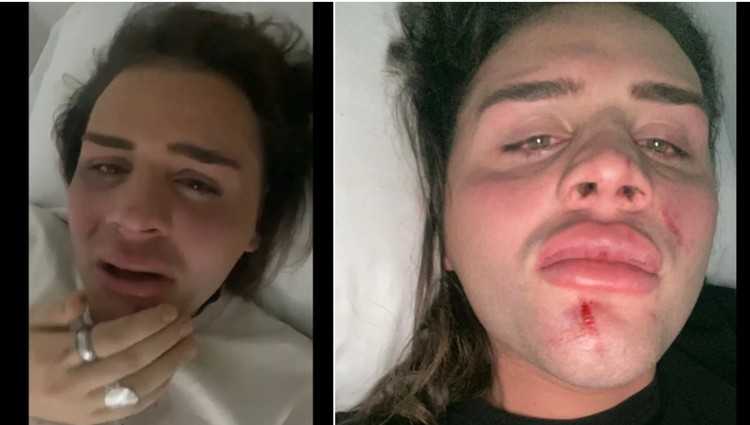 გიორგი მასხულიას ცემისთვის დაკავებულ 3 პირს 2.000-2.000 ლარიანი გირაო შეეფარდა